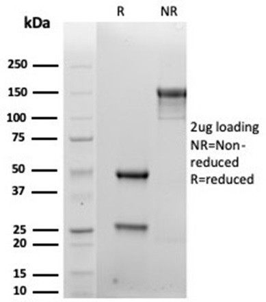 CD138/Syndecan-1 (SDC1) (Plasma Cell Marker) Antibody in SDS-PAGE (SDS-PAGE)