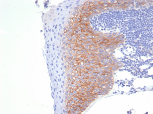 CD138/Syndecan-1 (SDC1) (Plasma Cell Marker) Antibody in Immunohistochemistry (Paraffin) (IHC (P))