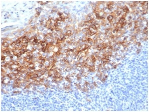 CD138/Syndecan-1 (SDC1) (Plasma Cell Marker) Antibody in Immunohistochemistry (Paraffin) (IHC (P))