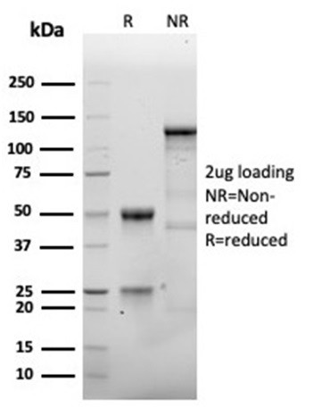 CD138/Syndecan-1 (SDC1) (Plasma Cell Marker) Antibody in SDS-PAGE (SDS-PAGE)