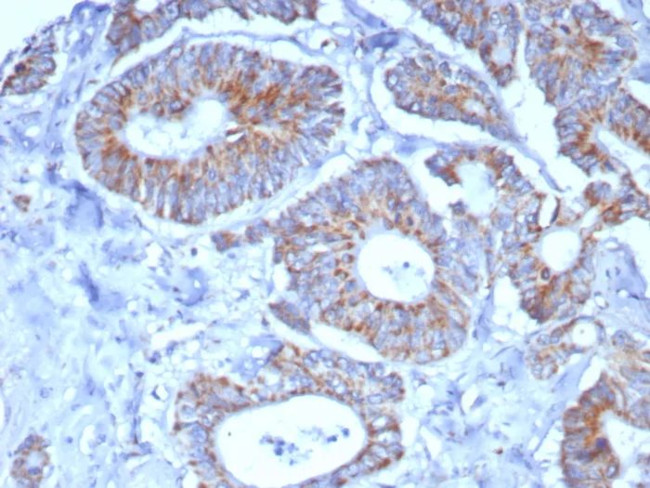 SDHA (Succinate Dehydrogenase Complex Flavoprotein Subunit A) Antibody in Immunohistochemistry (Paraffin) (IHC (P))