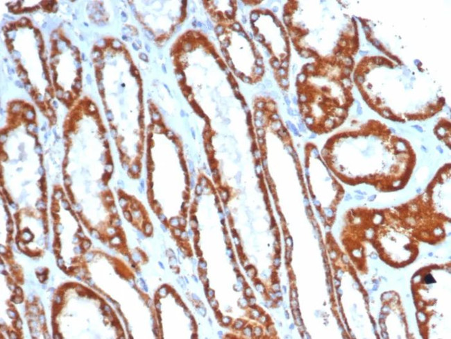 SDHA (Succinate Dehydrogenase Complex Flavoprotein Subunit A) Antibody in Immunohistochemistry (Paraffin) (IHC (P))