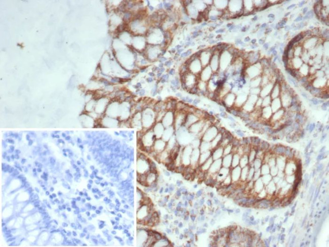 SDHA (Succinate Dehydrogenase Complex Flavoprotein Subunit A) Antibody in Immunohistochemistry (Paraffin) (IHC (P))