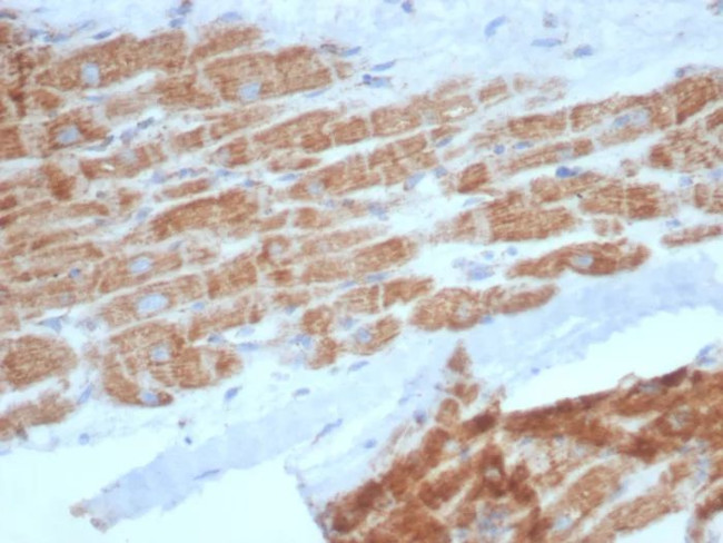 SDHA (Succinate Dehydrogenase Complex Flavoprotein Subunit A) Antibody in Immunohistochemistry (Paraffin) (IHC (P))