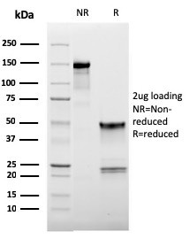 CD62L (L-Selectin) Antibody in SDS-PAGE (SDS-PAGE)