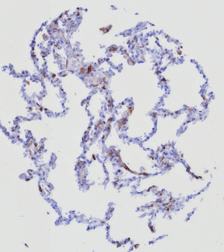 CD162 (Selectin P Ligand) Antibody in Immunohistochemistry (Paraffin) (IHC (P))