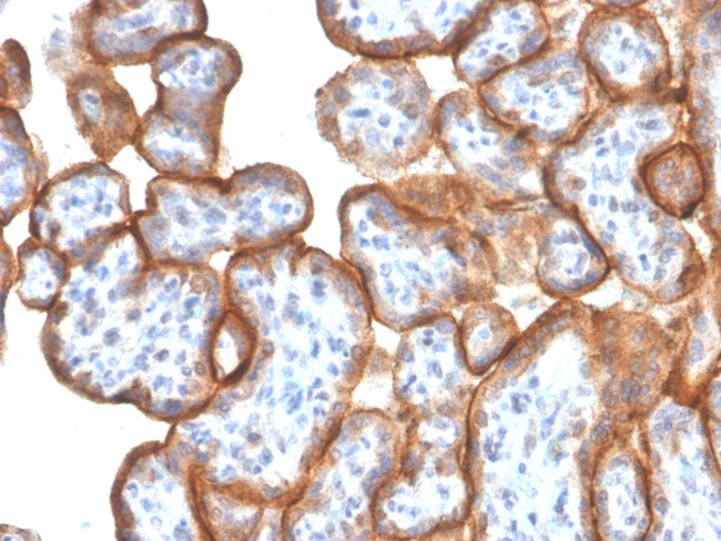 VISTA/GI24 (Negative Regulator of Immune Response) Antibody in Immunohistochemistry (Paraffin) (IHC (P))