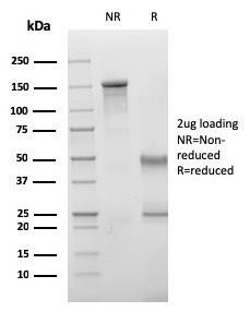 VISTA/GI24 (Negative Regulator of Immune Response) Antibody in SDS-PAGE (SDS-PAGE)