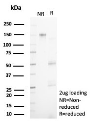 NECAB1/EF-hand calcium binding protein 1 Antibody in SDS-PAGE (SDS-PAGE)