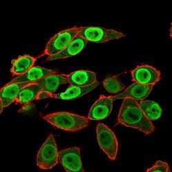 SET Antibody in Immunocytochemistry (ICC/IF)