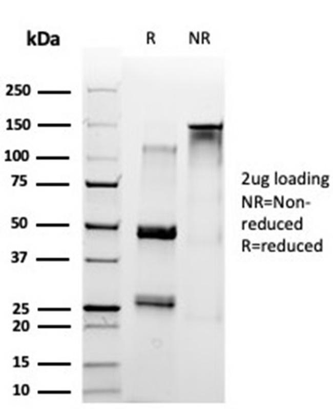 SET Antibody in SDS-PAGE (SDS-PAGE)