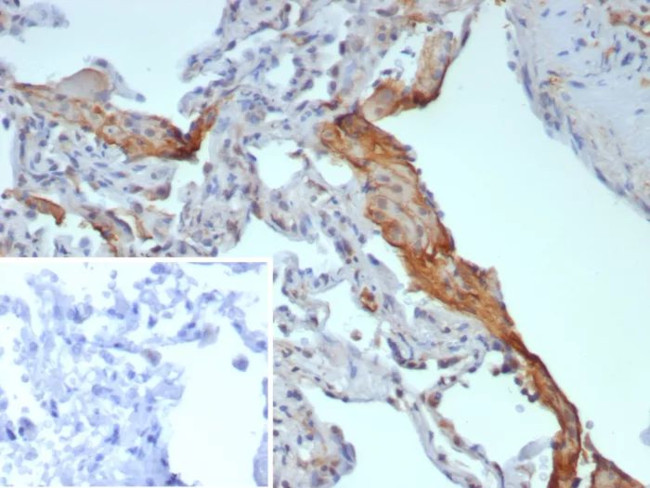 Pulmonary Surfactant-Associated Protein D (SFTPD) Antibody in Immunohistochemistry (Paraffin) (IHC (P))