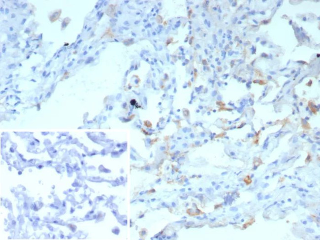 Pulmonary Surfactant-Associated Protein D (SFTPD) Antibody in Immunohistochemistry (Paraffin) (IHC (P))