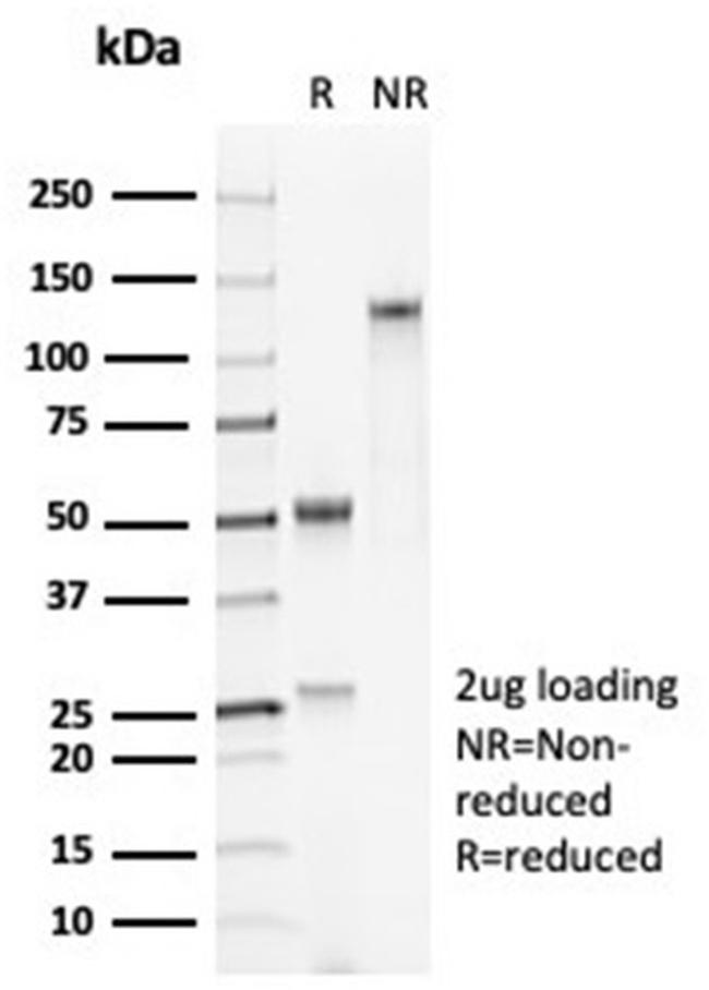 Pulmonary Surfactant-Associated Protein D (SFTPD) Antibody in Immunoelectrophoresis (IE)