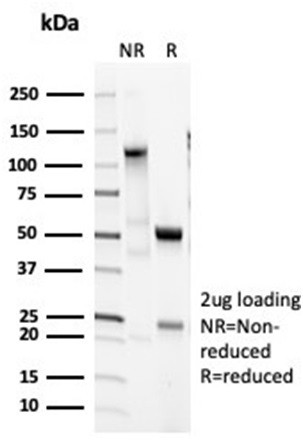 Pulmonary Surfactant-Associated Protein D (SFTPD) Antibody in SDS-PAGE (SDS-PAGE)