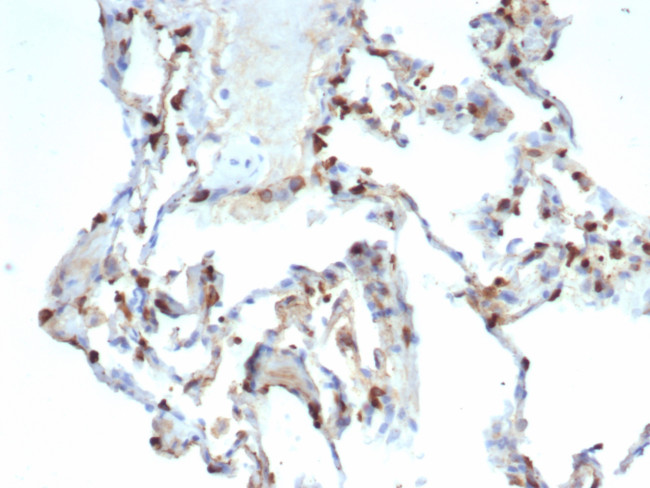 Pulmonary Surfactant-Associated Protein D (SFTPD) Antibody in Immunohistochemistry (Paraffin) (IHC (P))