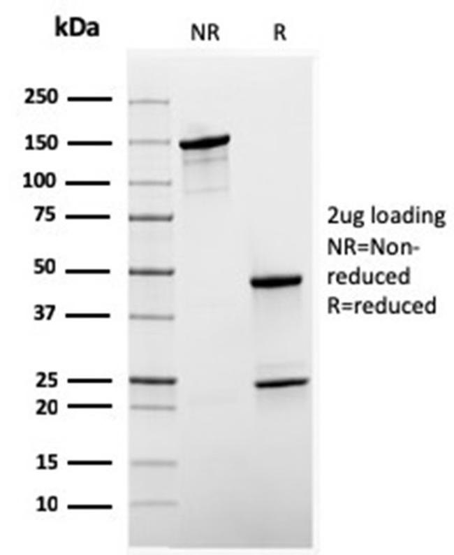 Sex Hormone Binding Globulin (SHBG) Antibody in Immunoelectrophoresis (IE)