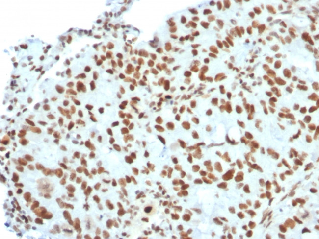 BMI1 Antibody in Immunohistochemistry (Paraffin) (IHC (P))