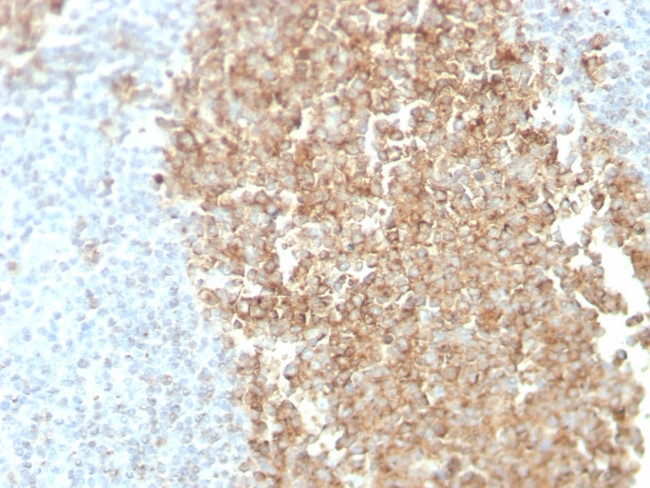 CDw75 (B-Cell Marker) Antibody in Immunohistochemistry (Paraffin) (IHC (P))