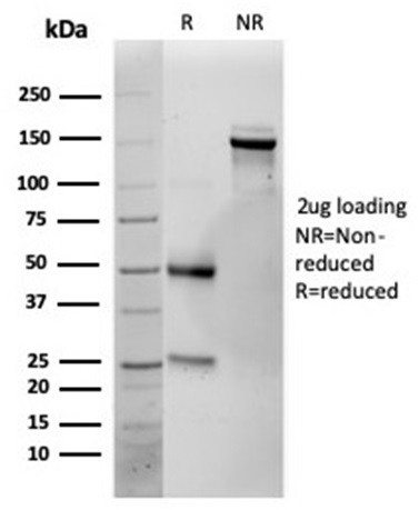 Interleukin-25 (IL-25)/IL-17E Antibody in SDS-PAGE (SDS-PAGE)