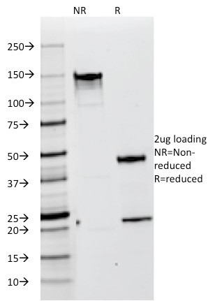 gp100/Melanosome/PMEL17/SILV (Melanoma Marker) Antibody in SDS-PAGE (SDS-PAGE)