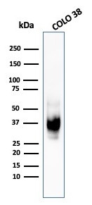 gp100/Melanosome/PMEL17/SILV (Melanoma Marker) Antibody in Western Blot (WB)