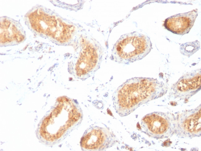 gp100/Melanosome/PMEL17/SILV (Melanoma Marker) Antibody in Immunohistochemistry (Paraffin) (IHC (P))