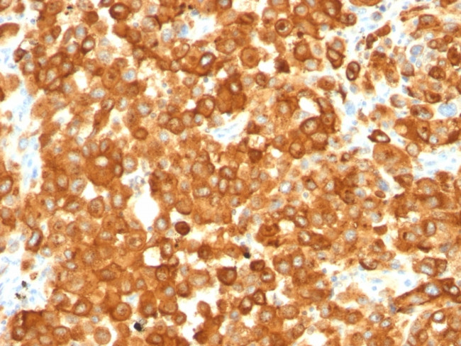 gp100/Melanosome/PMEL17/SILV (Melanoma Marker) Antibody in Immunohistochemistry (Paraffin) (IHC (P))