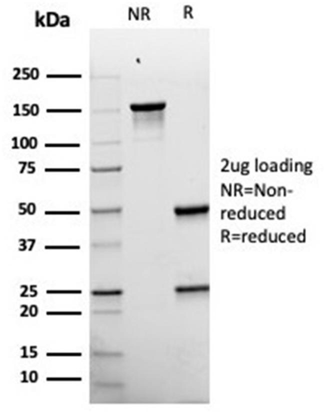 gp100/Melanosome/PMEL17/SILV (Melanoma Marker) Antibody in Immunoelectrophoresis (IE)