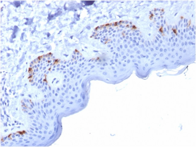 gp100/Melanosome/PMEL17/SILV (Melanoma Marker) Antibody in Immunohistochemistry (Paraffin) (IHC (P))