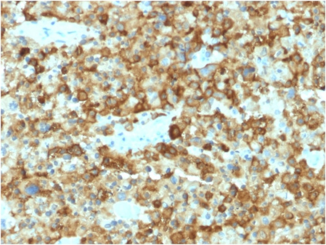 gp100/Melanosome/PMEL17/SILV (Melanoma Marker) Antibody in Immunohistochemistry (Paraffin) (IHC (P))