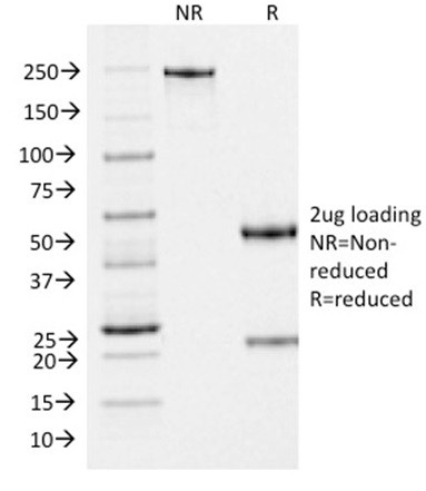 gp100/Melanosome/PMEL17/SILV (Melanoma Marker) Antibody in SDS-PAGE (SDS-PAGE)