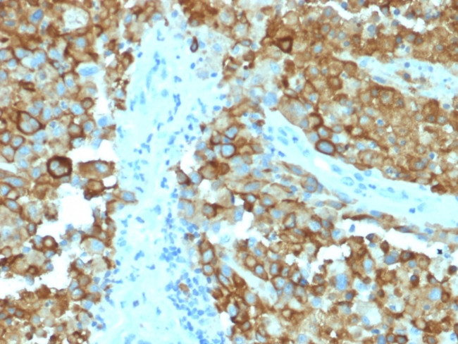 gp100/Melanosome/PMEL17/SILV Antibody in Immunohistochemistry (Paraffin) (IHC (P))