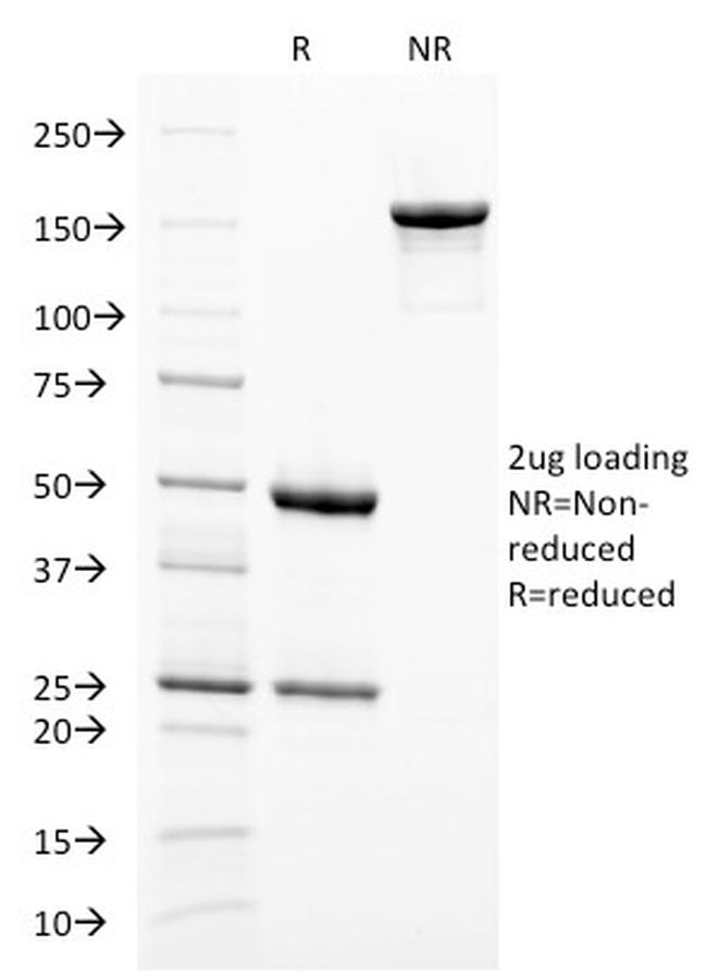 gp100/Melanosome/PMEL17/SILV Antibody in SDS-PAGE (SDS-PAGE)