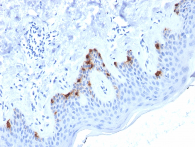 gp100/Melanosome/PMEL17/SILV Antibody in Immunohistochemistry (Paraffin) (IHC (P))