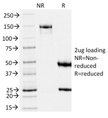 gp100/Melanosome/PMEL17/SILV (Melanoma Marker) Antibody in SDS-PAGE (SDS-PAGE)