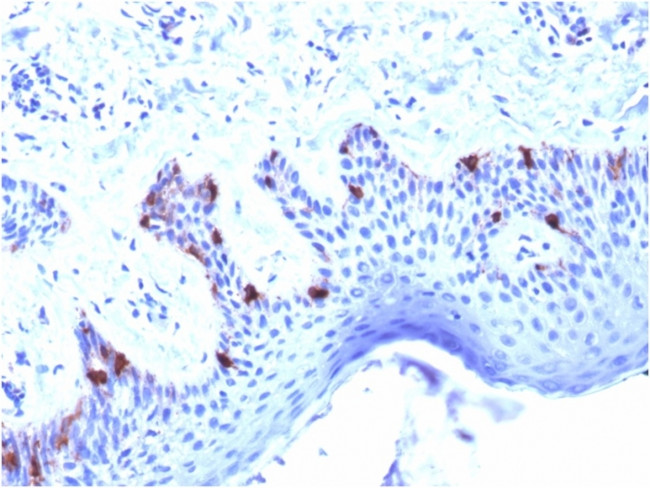 gp100/Melanosome/PMEL17/SILV (Melanoma Marker) Antibody in Immunohistochemistry (Paraffin) (IHC (P))