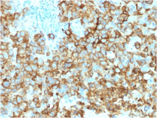 gp100/Melanosome/PMEL17/SILV (Melanoma Marker) Antibody in Immunohistochemistry (Paraffin) (IHC (P))