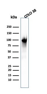 gp100/Melanosome/PMEL17/SILV (Melanoma Marker) Antibody in Western Blot (WB)