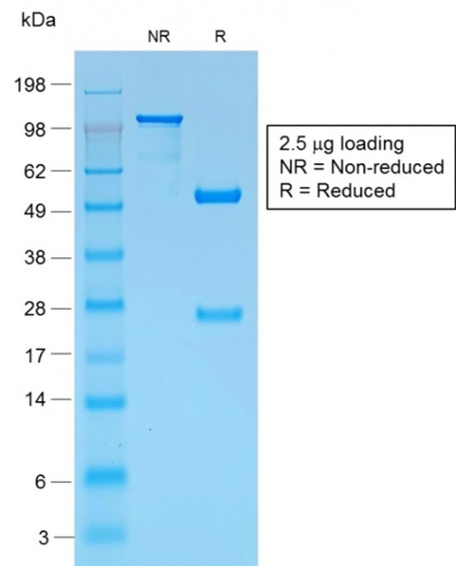 gp100/Melanosome/PMEL17/SILV Antibody in SDS-PAGE (SDS-PAGE)