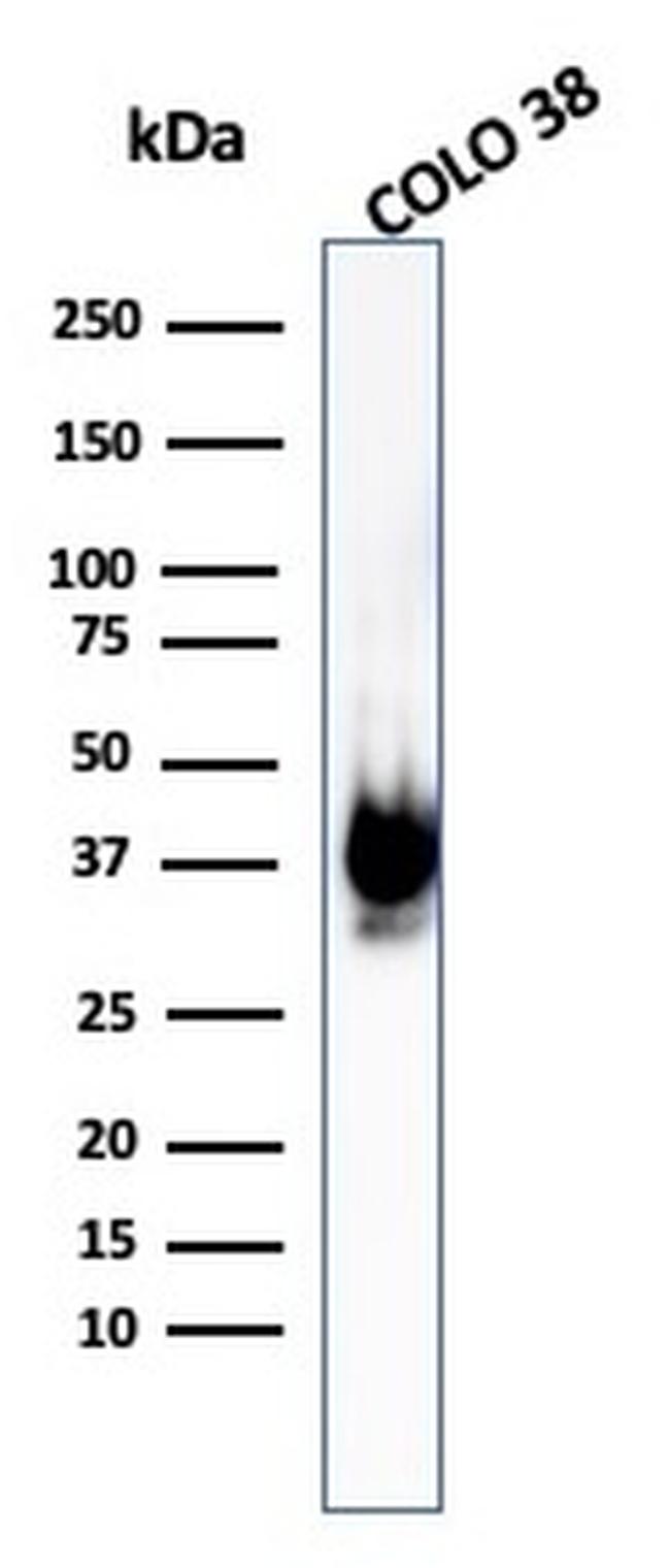 gp100/Melanosome/PMEL17/SILV Antibody in Western Blot (WB)