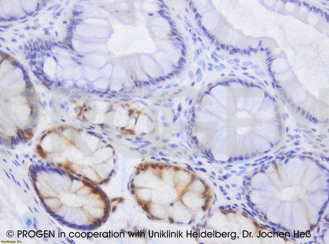 Plakophilin 2 Multiepitope Antibody in Immunohistochemistry (IHC)