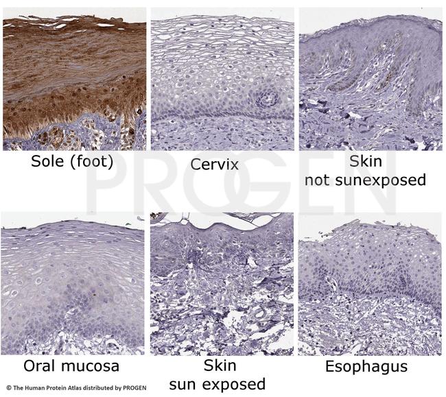 KRT9 Antibody in Immunohistochemistry (IHC)