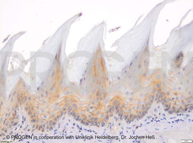 Plakophilin 3 Antibody in Immunohistochemistry (IHC)