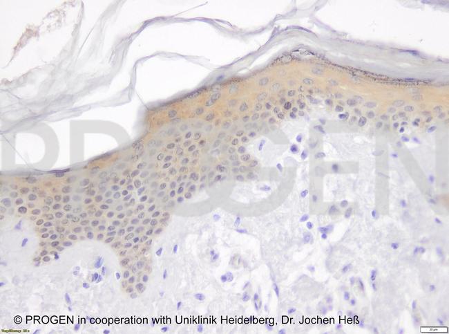 Plakophilin 3 Antibody in Immunohistochemistry (IHC)