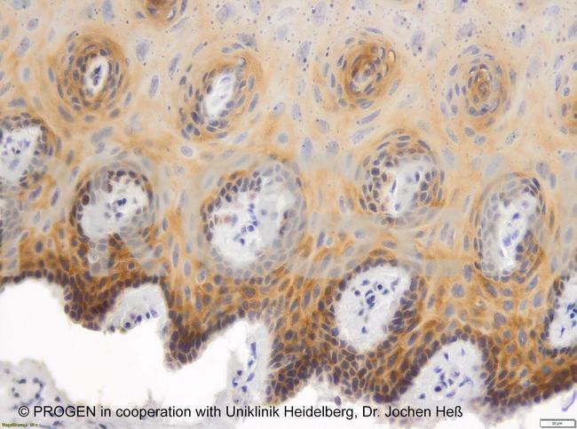 Plakophilin 3 Antibody in Immunohistochemistry (IHC)