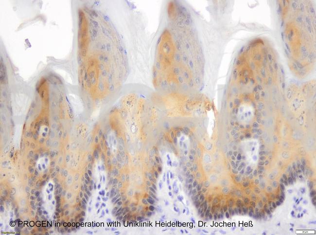 Plakophilin 3 Antibody in Immunohistochemistry (IHC)