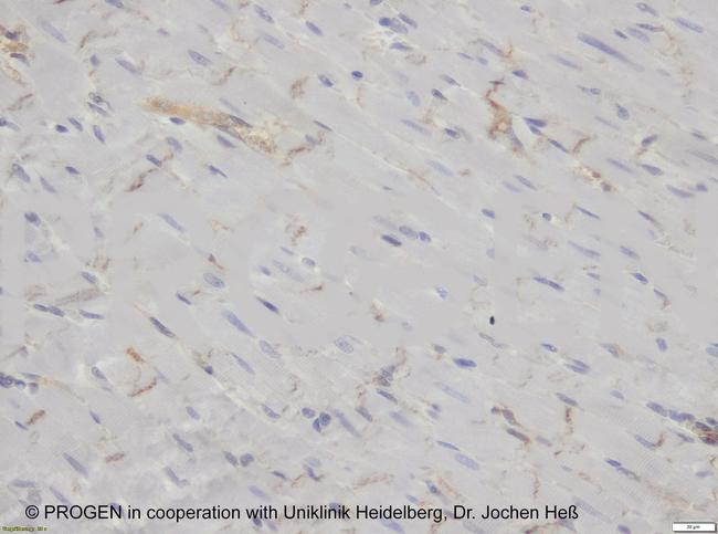 Desmoglein 2 Antibody in Immunohistochemistry (IHC)