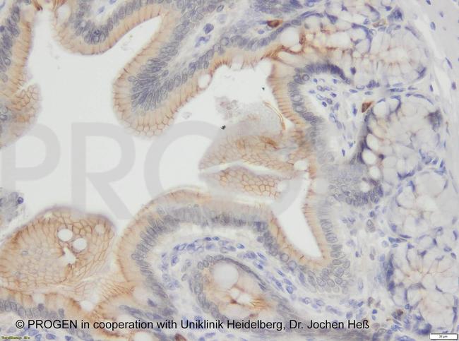 Desmoglein 2 Antibody in Immunohistochemistry (IHC)