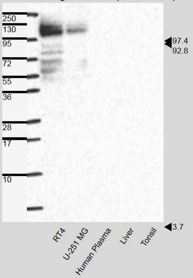 Plakophilin 2 Antibody in Western Blot (WB)